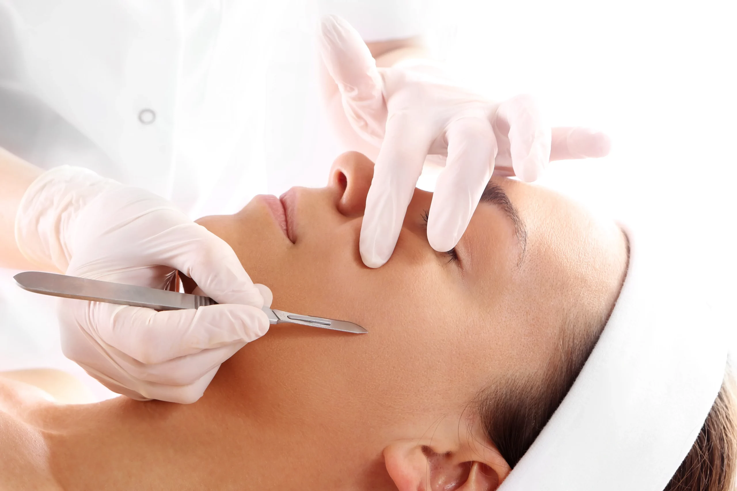 Dermaplaning with MicroPeel or Mask in Avon, CT