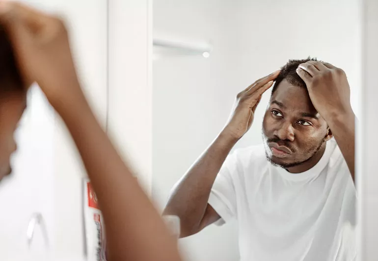 Hair-Loss-regenerative-aesthetics-and-dermatology-laguna-hills-ca