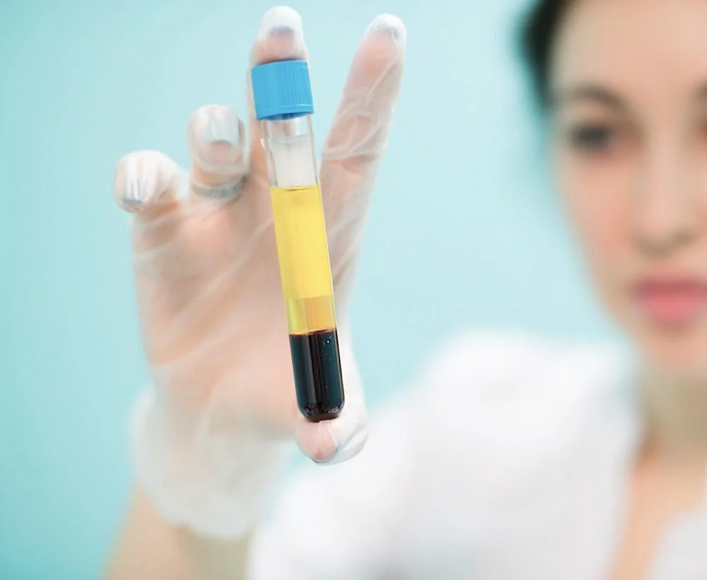 PRP-Injections-regenerative-aesthetics-and-dermatology-laguna-hills-ca