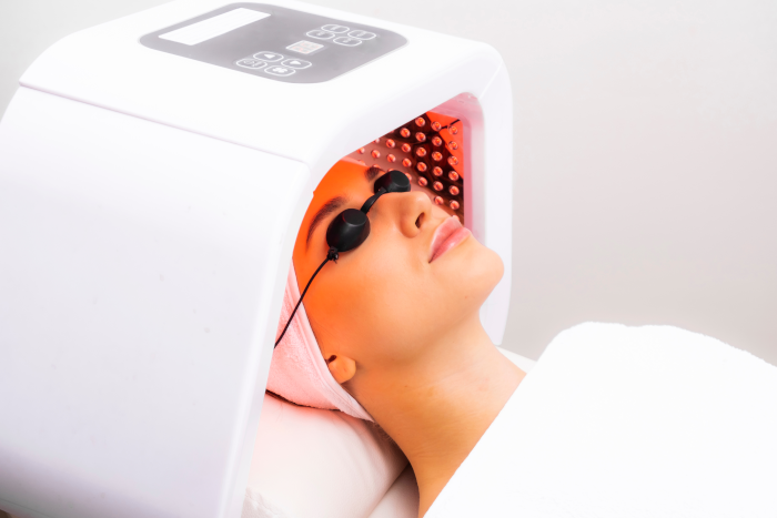 Photodynamic-Therapy-regenerative-aesthetics-and-dermatology-laguna-hills-ca