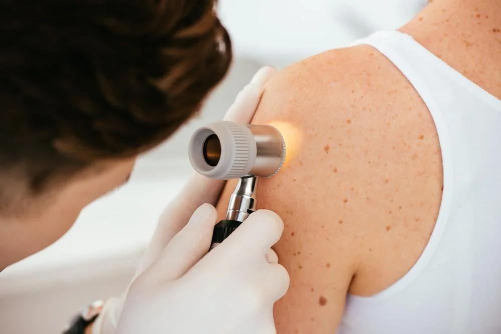 Skin-Cancer-Screening-regenerative-aesthetics-and-dermatology-laguna-hills-ca