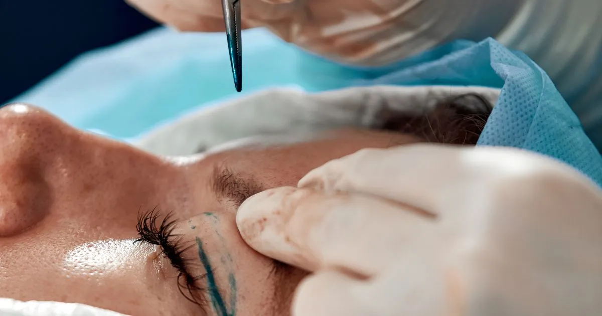 A women receiving Blepharoplasty surgery in Laguna Hills CA